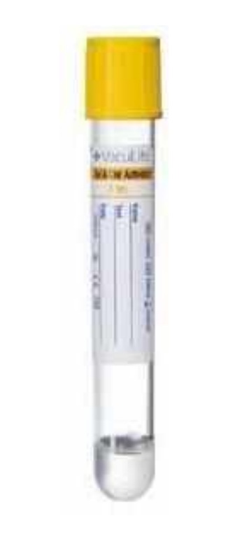 ВакуЛайф Одноразові вакуумні пробірки для забору крові, гель та активатор згортання, 13×100 мм (mm), 5 мл (ml)